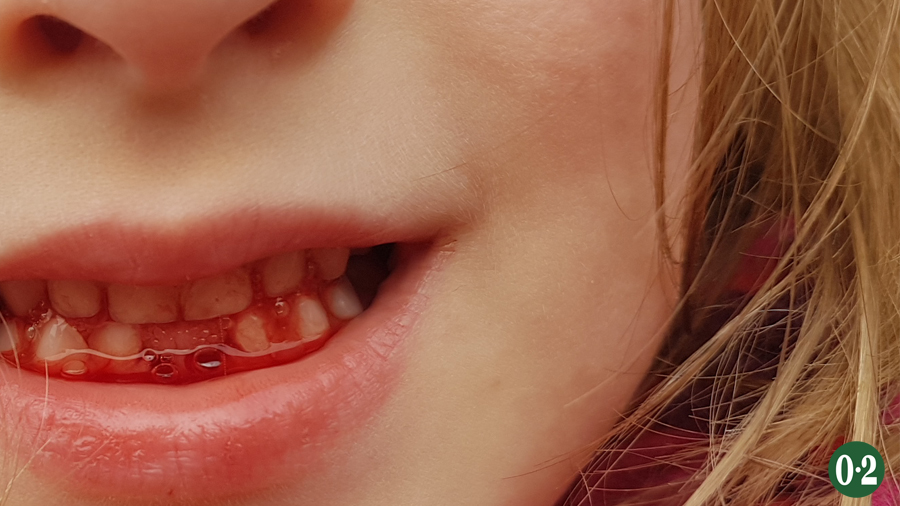 Oktober 2019: Die June mit erster Zahnlücke